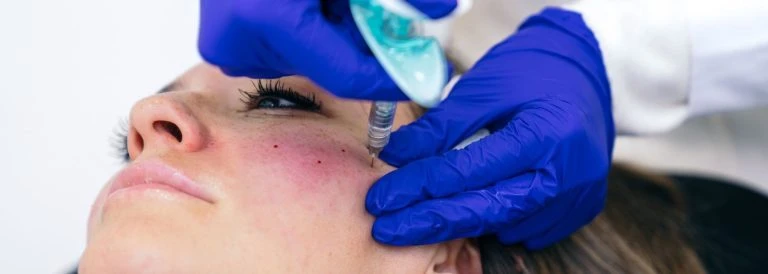 ¿Cuáles son las diferencias entre neuromoduladores y ácido hialurónico y cómo elegir el mejor?